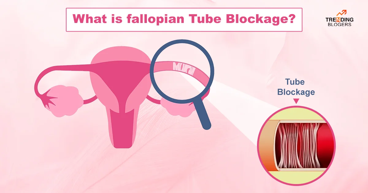 fallopian Tube Blockage