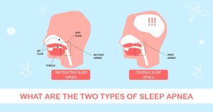 Two types of sleep apnea